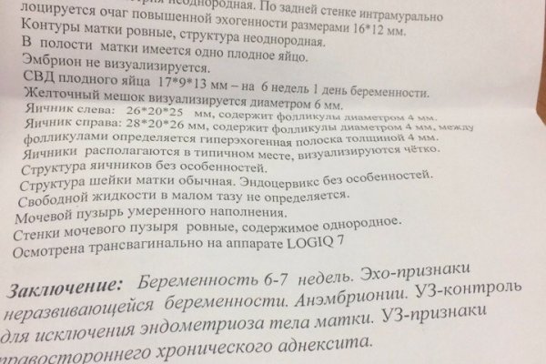 Через какой браузер можно зайти на кракен
